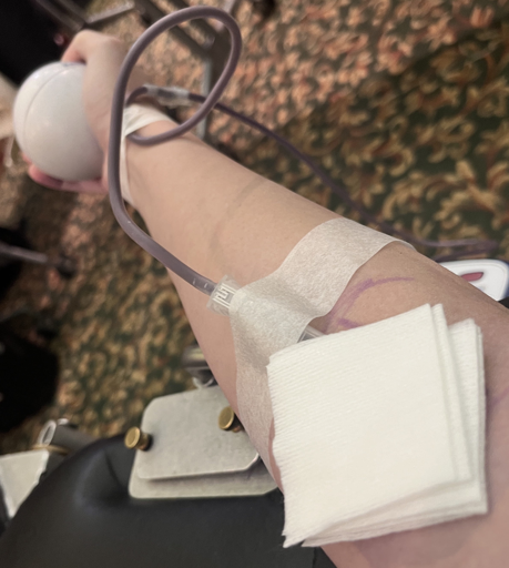 An arm marked up by a phlebotomist for blood donation, with a wire pulling blood out. The person's hand holds a squeezy ball.